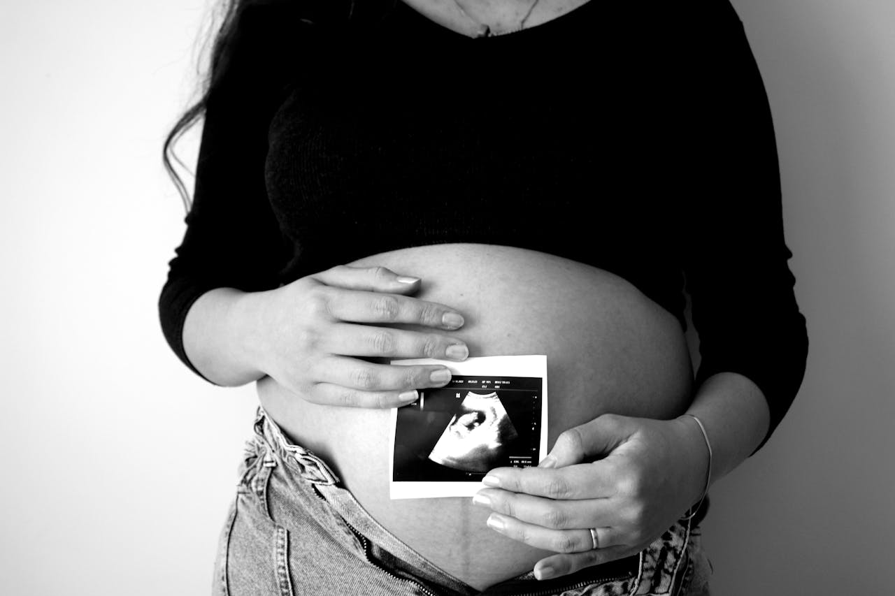 A pregnant woman holds an ultrasound photo against her belly, symbolizing expecting motherhood.